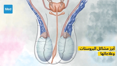 أبرز مشاكل البروستات وعلاجاتها