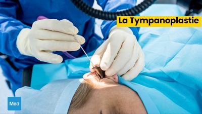 La Tympanoplastie : Restaurer l