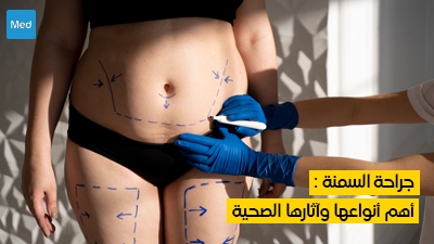 جراحة السمنة : أهم أنواعها وآثارها الصحية