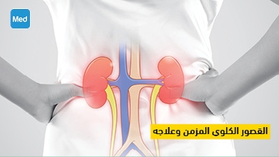 القصور الكلوي المزمن وعلاجه