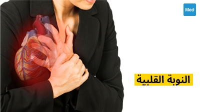 النوبة القلبية 