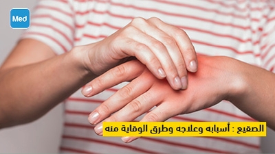 الصقيع : أسبابه وعلاجه وطرق الوقاية منه