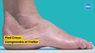 Pied Creux : Comprendre et Traiter