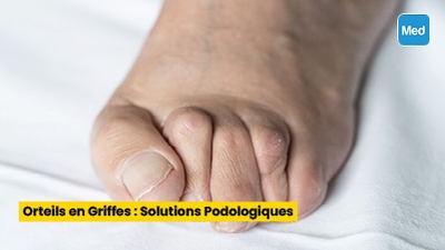 Orteils en Griffes : Solutions Podologiques