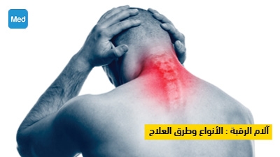 آلام الرقبة : الأنواع وطرق العلاج