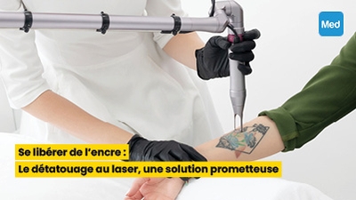 Se libérer de l'encre : Le détatouage au laser, une solution prometteuse