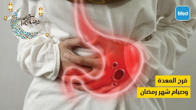 قرح المعدة وصيام شهر رمضان 