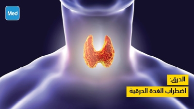 الدرق: اضطراب الغدة الدرقية