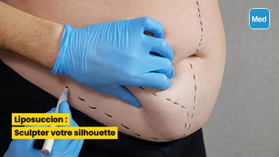 Liposuccion : Sculpter votre silhouette