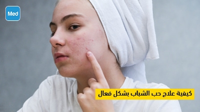 كيفية علاج حب الشباب بشكل فعال