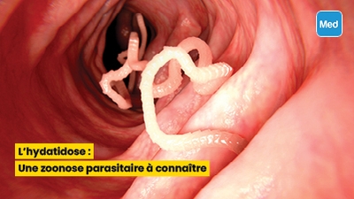 L'hydatidose : Une zoonose parasitaire à connaître