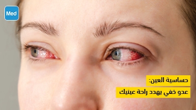 حساسية العين: عدو خفي يهدد راحة عينيك
