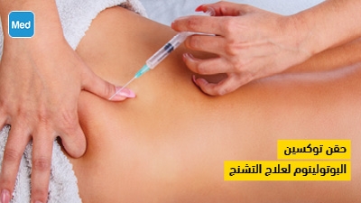 حقن توكسين البوتولينوم لعلاج التشنج