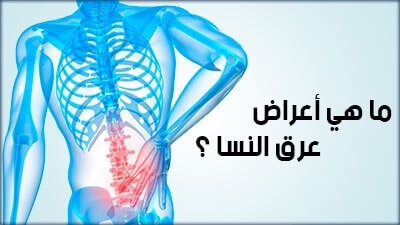 ما هي أعراض عرق النسا  