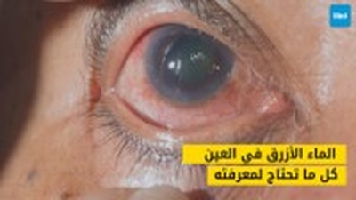 الماء الأزرق: كل ما تحتاج معرفته عن الزرق العيني