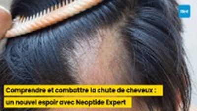 Comprendre et combattre la chute de cheveux : un nouvel espoir avec Neoptide Expert