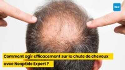 Comment agir efficacement sur la chute de cheveux avec Neoptide Expert ?