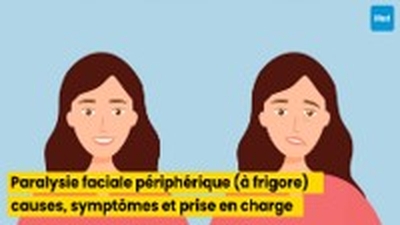 Paralysie faciale périphérique (à frigore) : causes, symptômes et prise en charge