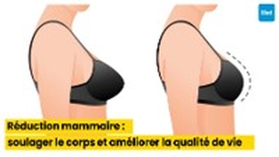 Réduction mammaire : soulager le corps et améliorer la qualité de vie