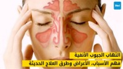 التهاب الجيوب الأنفية: فهم الأسباب، الأعراض وطرق العلاج الحديثة
