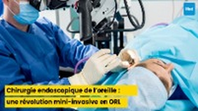 Chirurgie endoscopique de l’oreille : une révolution mini-invasive en ORL