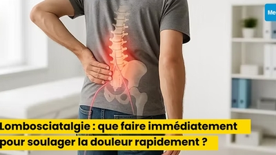Lombosciatalgie : que faire immédiatement pour soulager la douleur rapidement ?