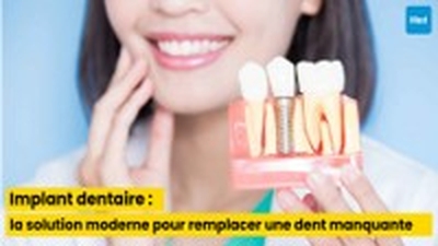 Implant dentaire : la solution moderne pour remplacer une dent manquante