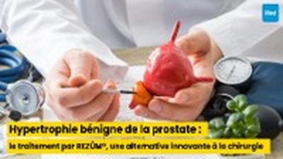 Hypertrophie bénigne de la prostate : le traitement par REZŪM®, une alternative innovante à la chirurgie