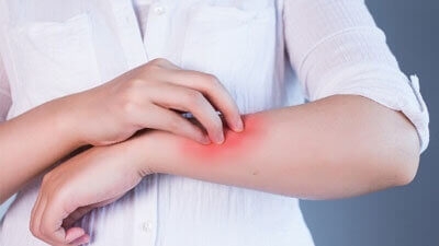 Antifongiques naturels