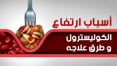 أسباب ارتفاع الكوليسترول وطرق علاجه