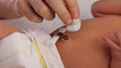 6 أخطاء شائعة تجنبيها خلال تنظيف سرة رضيعك