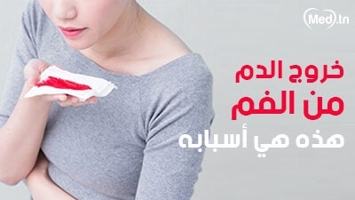 خروج الدم من الفم هذه هي أسبابه