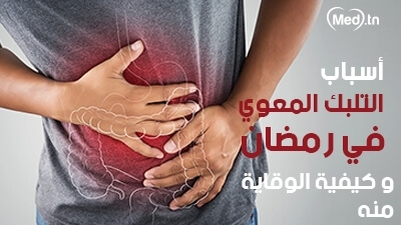 أسباب التلبك المعوي في رمضان وكيفية الوقاية منه