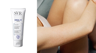 الصدفية: علاج الصدفية