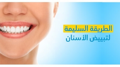 الطريقة السليمة لتبييض الأسنان
