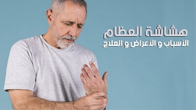 هشاشة العظام : الأسباب و الأعراض و العلاج