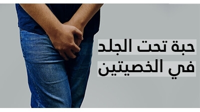 حبة تحت الجلد في الخصيتين : انواعها و كيفية علاجها