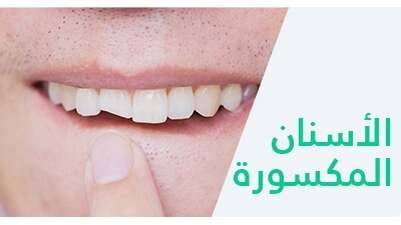 الأسنان المكسورة