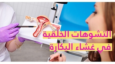 التشوّهات الخلقيّة في غشاء البكارة 