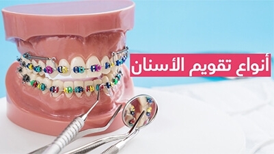 تقويم الأسنان