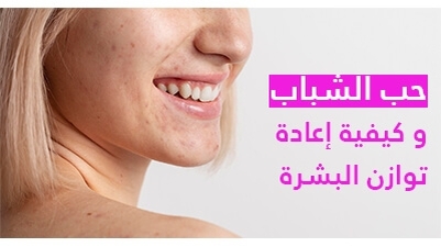 حب الشباب و كيفية إعادة 