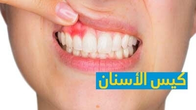 كيس الأسنان