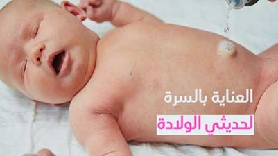 العناية بالسرة لحديثي الولادة