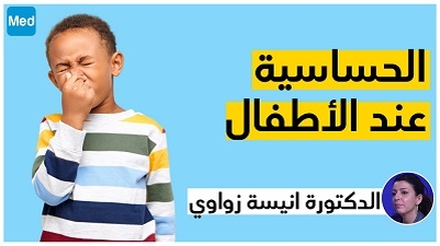 الحساسية عند الأطفال