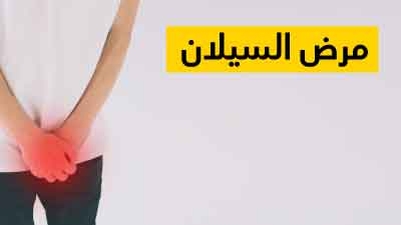 مرض السيلان