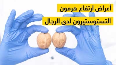 أعراض ارتفاع هرمون التستوستيرون لدى الرجال