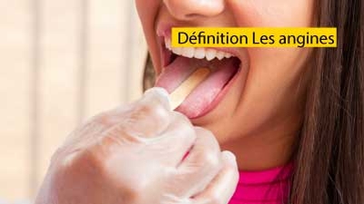Définition Les angines