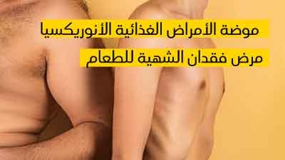 موضة الأمراض الغذائية الأنوريكسيا مرض فقدان الشهية للطعام