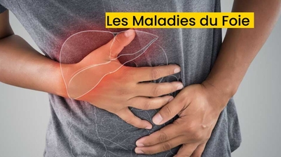 Les Maladies du Foie