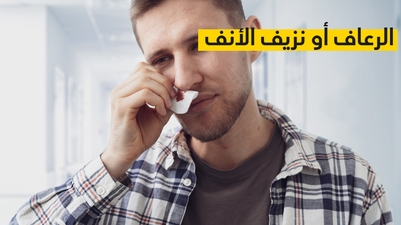 الرعاف أو نزيف الأنف